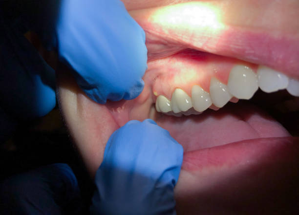Best 24-Hour Emergency Dentist in Minot Af, ND
