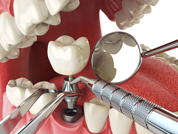 Best Emergency Treatment for Toothache in Minot Af, ND
