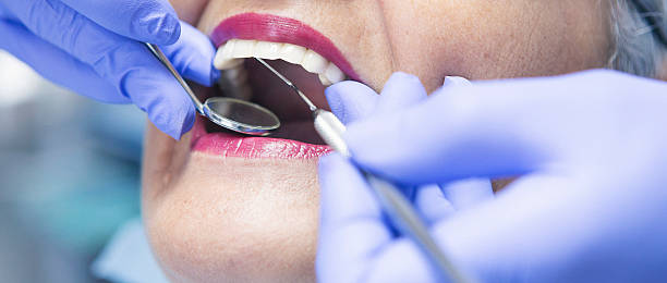 Best Emergency Tooth Extraction in Minot Af, ND